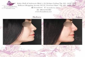 gallery img